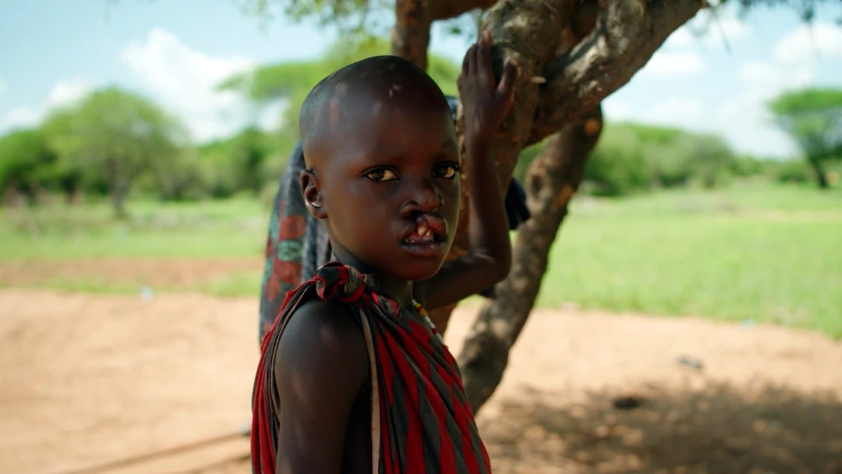 Operation Smile campaign thumbnail